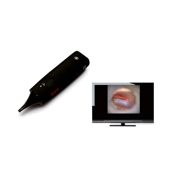 Otoscope Wireless Black Ck-ew938 - Spirit product available at family pharmacy online buy now at qatar doha