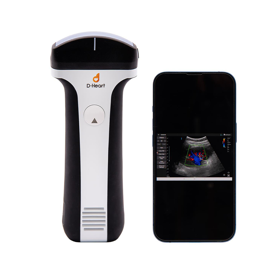 Portable Ultrasound Handheld Probe(lu700l)- D-heart product available at family pharmacy online buy now at qatar doha
