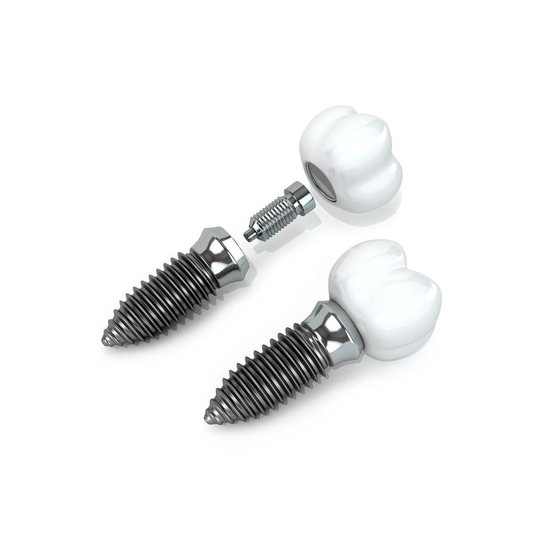 Screws available in online  pharmacy qatar, doha 