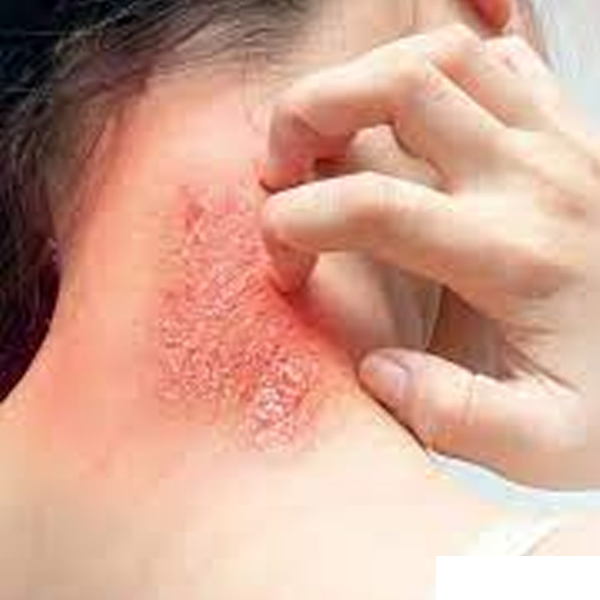 Skin Treatment, Antifungal Cream, Foot Care available in online  pharmacy qatar, doha 