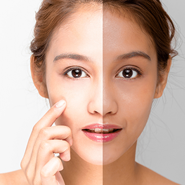 Body Whitening available in online  pharmacy qatar, doha 